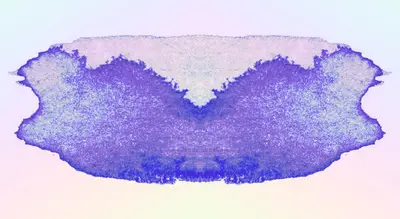 BLAUES STÜNDCHEN w. dj fat lip & hannahconda - EDM event at Klunkerkranich in Berlin